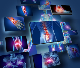 Orthopaedic testing and treatment